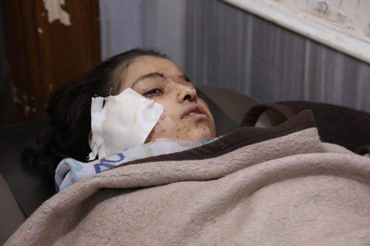 A Syrian girl lies in a makeshift hospital bed after she was wounded in an airstrike at the Ain Jalout school in Aleppo.