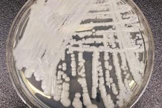 FILE - This undated photo made available by the Centers for Disease Control and Prevention shows a strain of Candida auris cultured in a petri dish at a CDC laboratory. Southern Nevada has emerged as the place in the U.S. with the highest number of cases of the potentially lethal fungus that is resistant to common antibiotics and can be a deadly risk to hospital and nursing home patients. (Shawn Lockhart/Centers for Disease Control and Prevention via AP, File)
