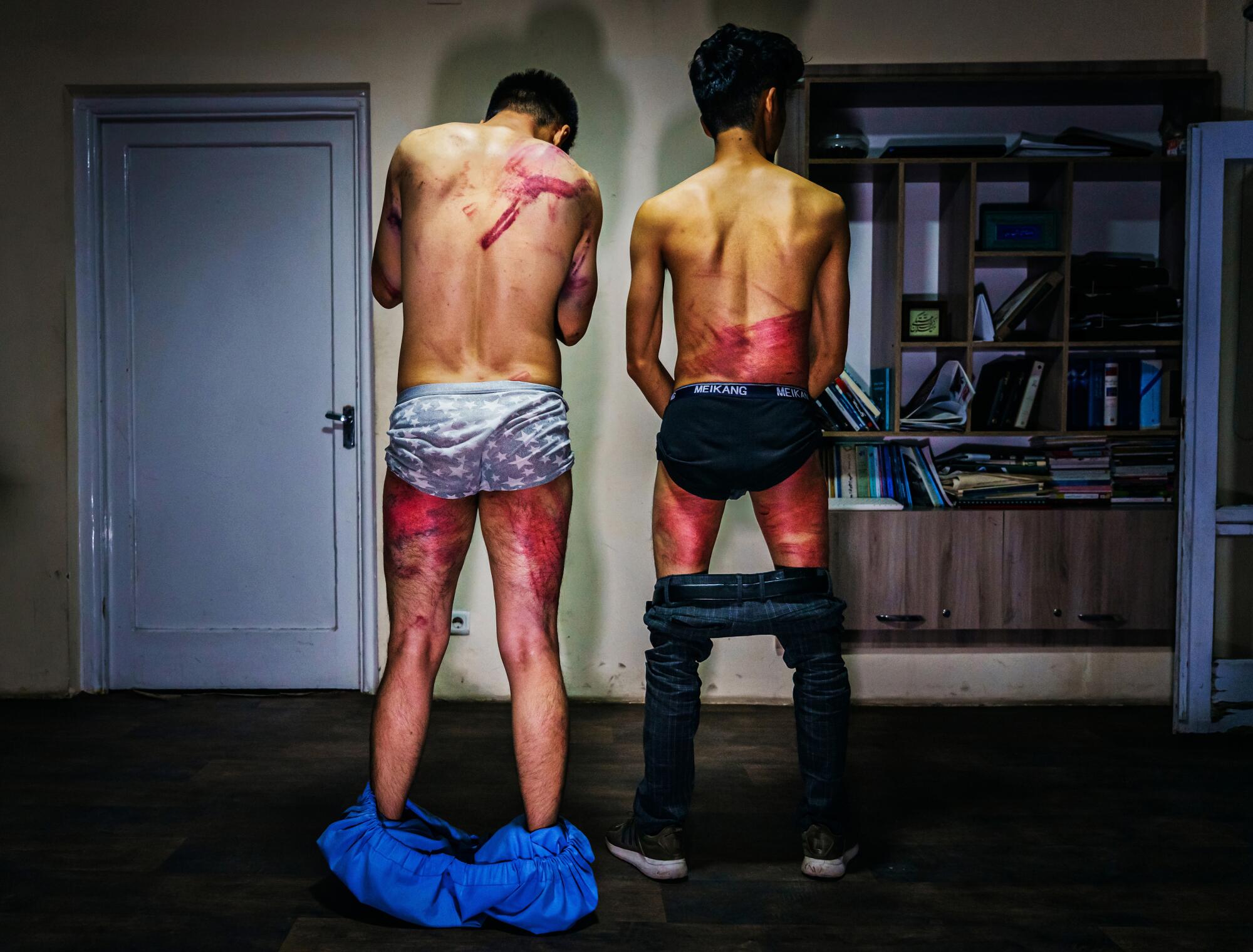 Two men bare the wounds on their back and legs.
