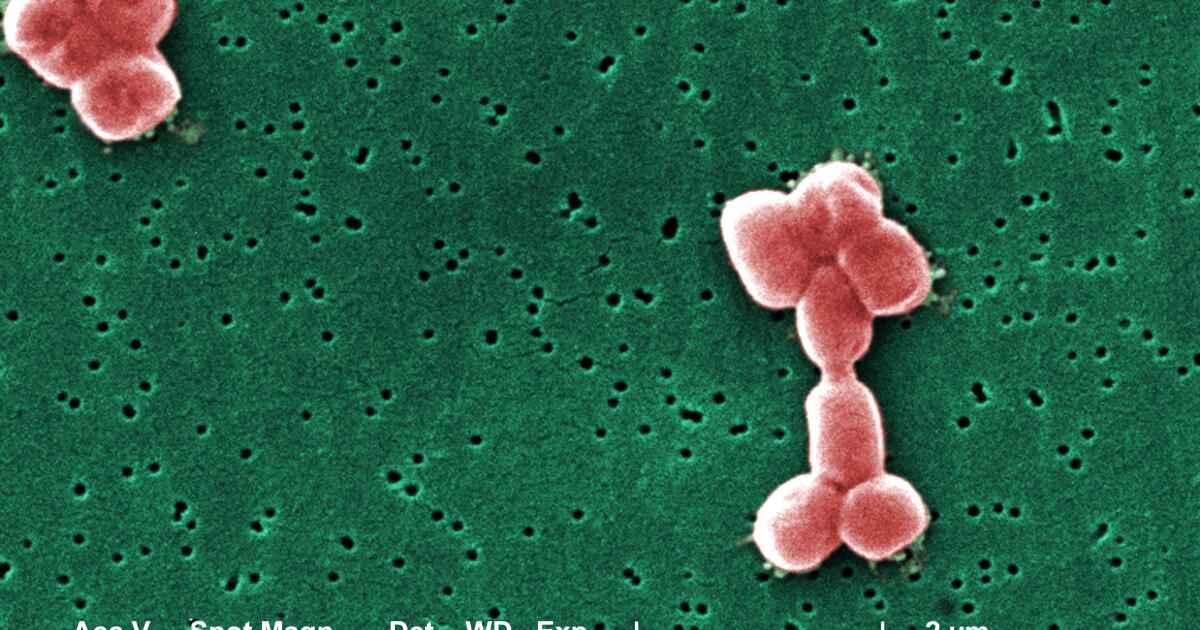Eine neue Art von Antibiotikum bekämpft arzneimittelresistente Keime, heißt es in einer Studie