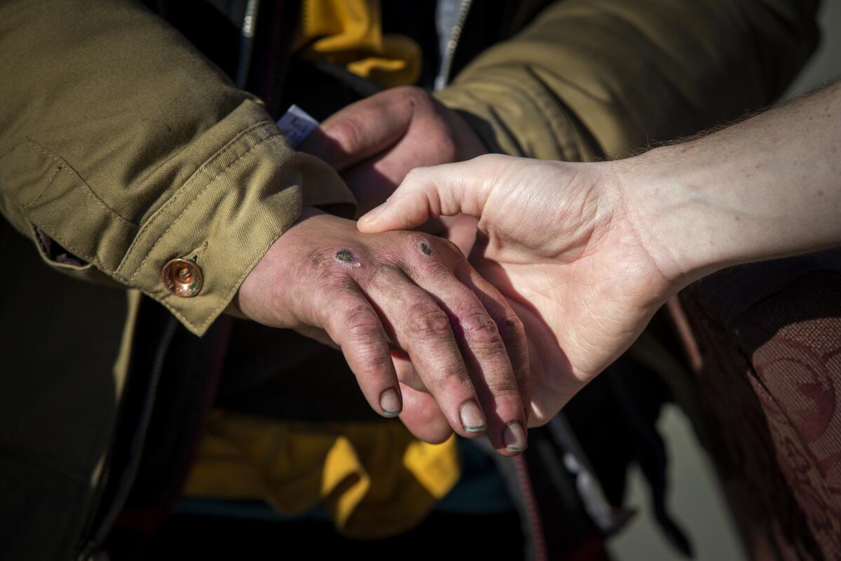 Dr. Michael Stefanowicz checks the wounds and possible broken finger on the hand of Clyde Hardy, 23, who has been homeless for two years.