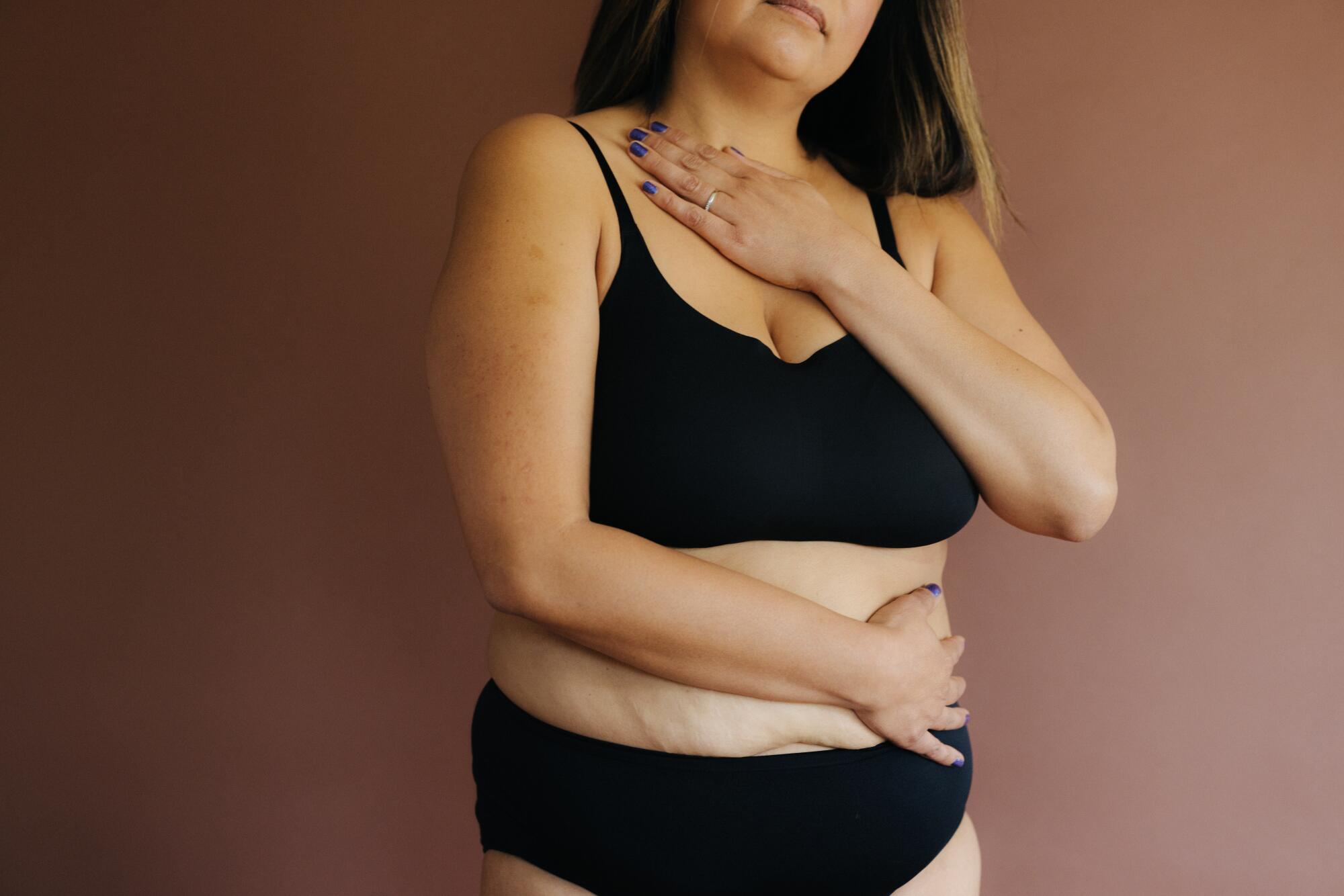 Powerful photos show women's bodies after giving birth - Los