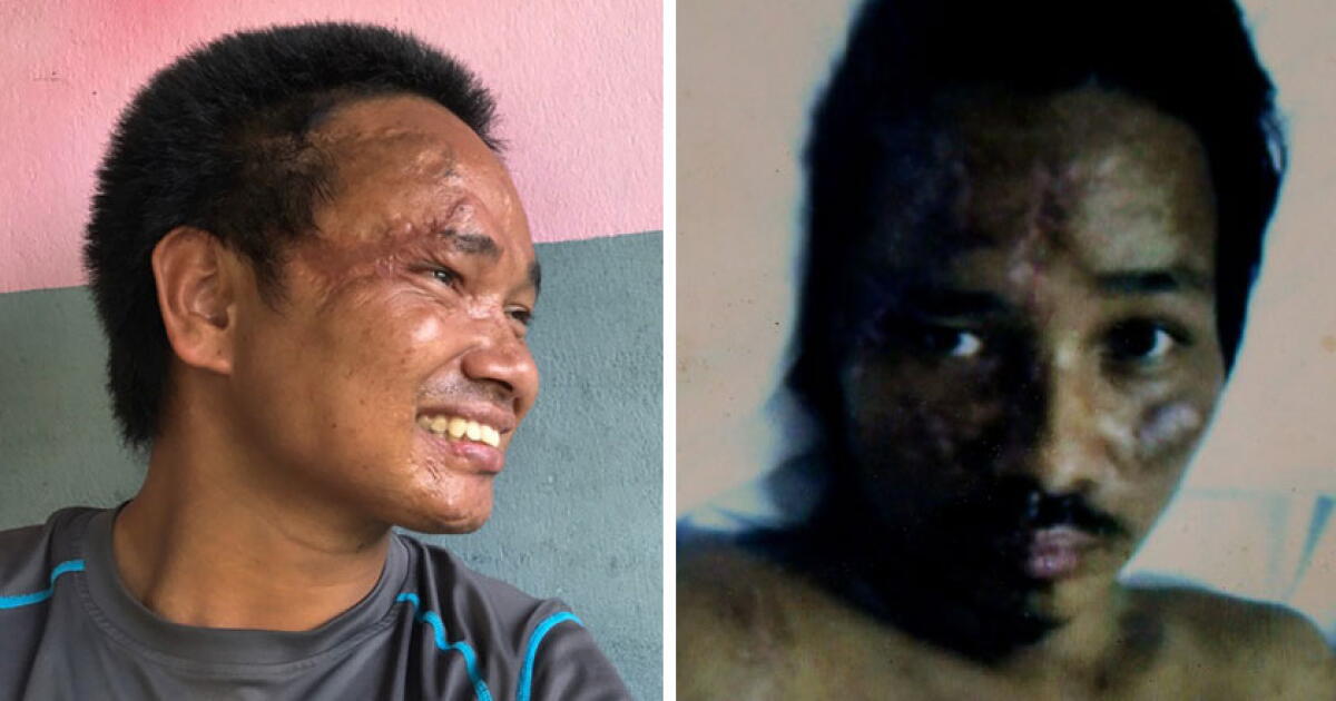 The Nepali man who came back from the dead