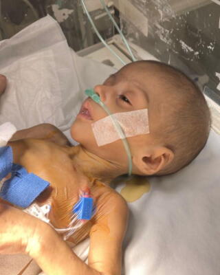 S.G.V. as a baby, taken in Mexico before treatment for short bowel syndrome.