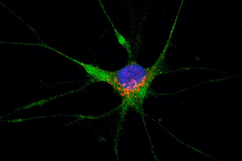 A single astrocyte cell displaying expression of the SARS-CoV-2 receptor protein ACE2 in red.