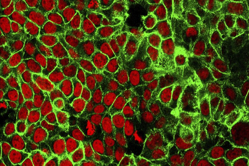 This microscope image made available by the National Cancer Institute Center for Cancer Research in 2015 shows human colon cancer cells with the nuclei stained red. On Friday, May 29, 2020, doctors are reporting success with newer drugs that control certain types of cancer better, reduce the risk it will come back and make treatment simpler and easier to bear. (NCI Center for Cancer Research via AP)