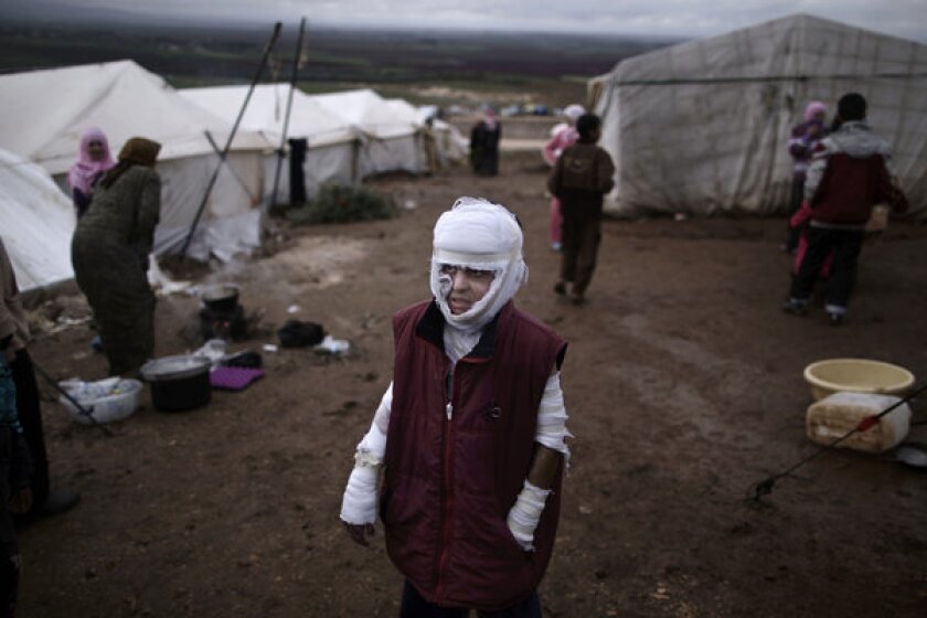 Abdullah Ahmed, 10, who suffered burns in a Syrian government airstrike and fled his home with his family, stands outside their tent at a camp in the village of Atmeh, Syria, on Dec. 11.
