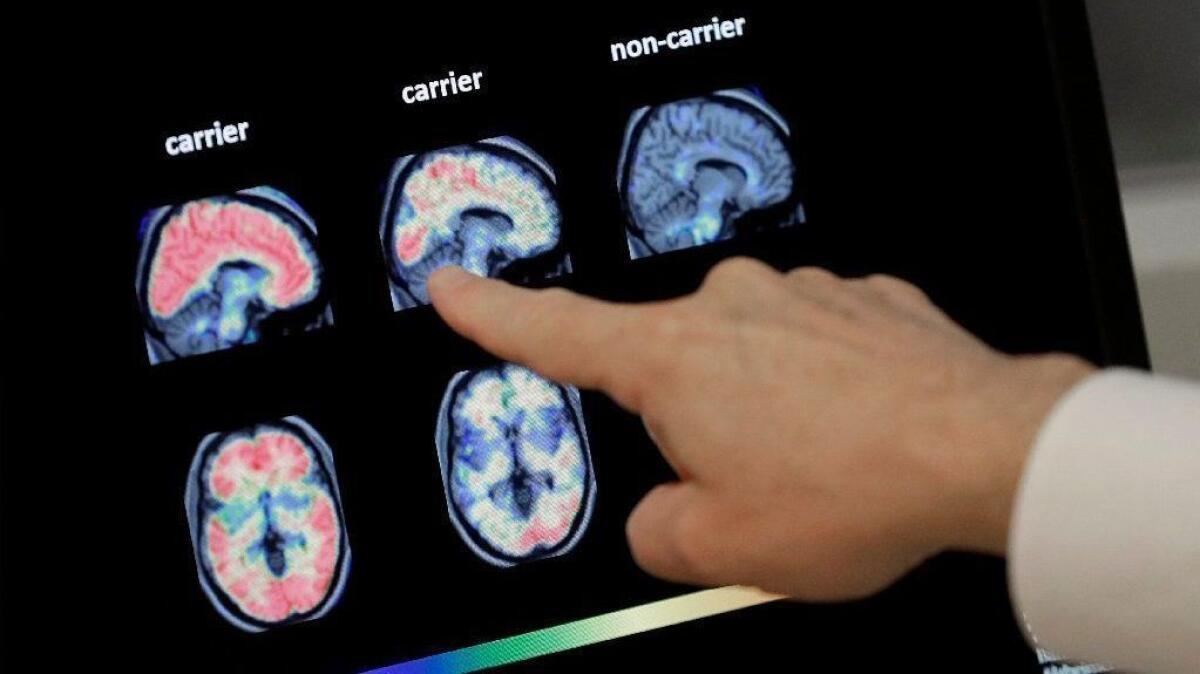 A doctor goes over images from a brain scan at the Banner Alzheimers Institute in Phoenix in 2018.