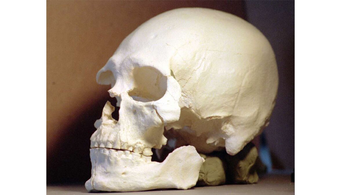 This plastic casting shows a controversial 9,200–year–old skull that belonged to Kennewick Man. New DNA analysis backs claims from tribes in the Northwest that he was a Native American.