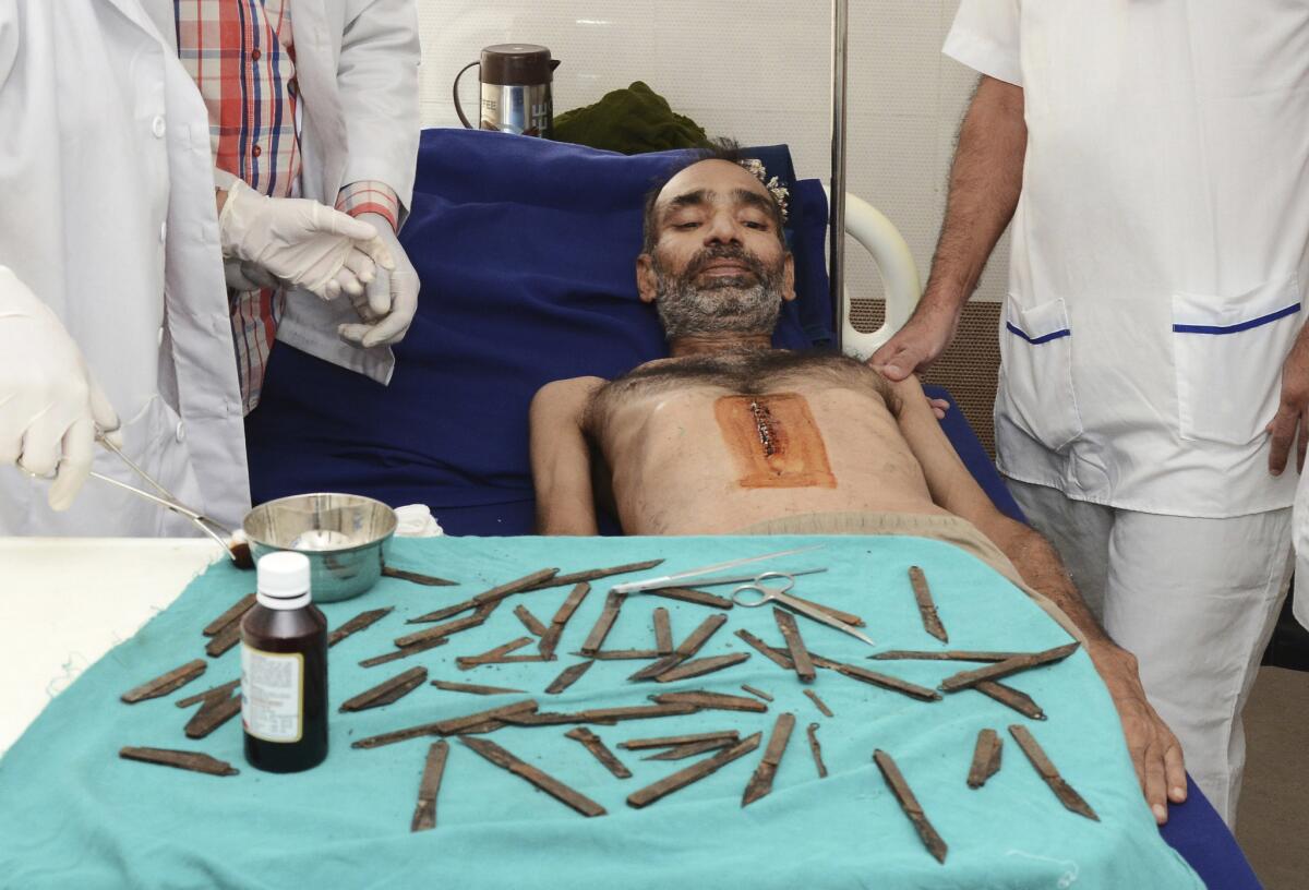 Police constable Surjeet Singh lies under a table displaying the 40 knifes removed from his stomach in a hospital in Amritsar, India, on Tuesday.