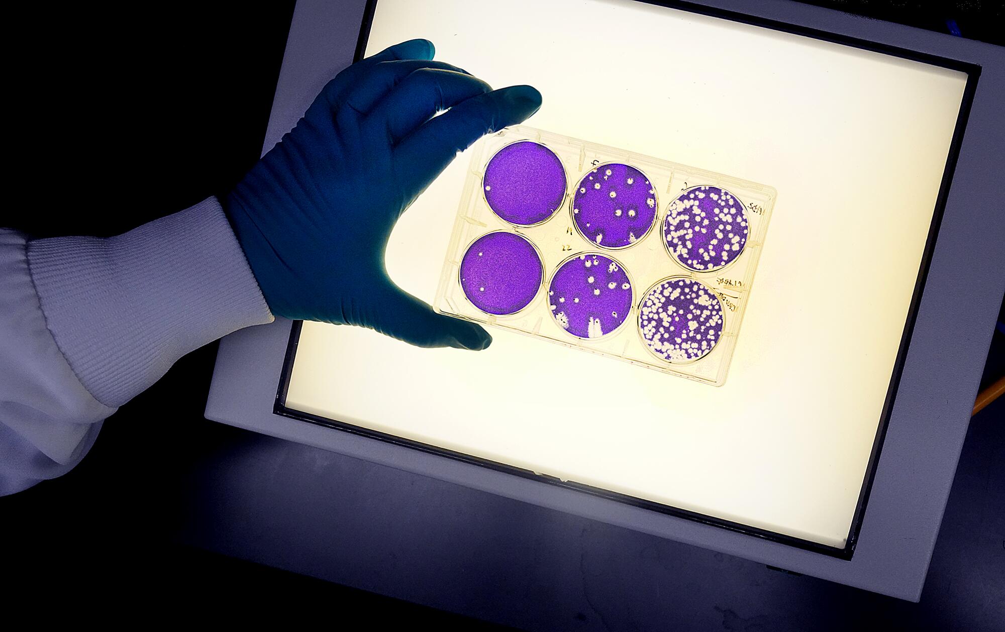 Lab samples are shown on a light table.