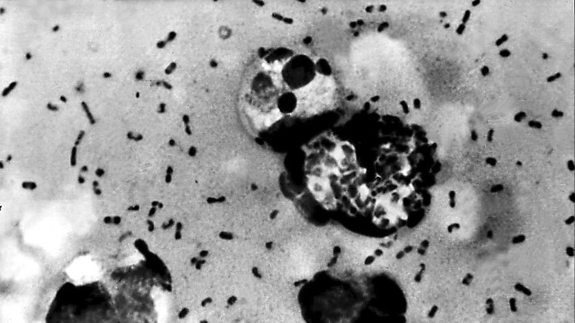 Bubonic plague bacteria taken from a patient in 2003.