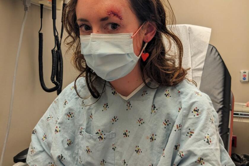 Eleanor Mead was one of several bicyclists to be struck by a car on Friday, Feb. 10, in the East Bay. She suffered a gash on her forehead. She was treated at Kaiser Oakland.