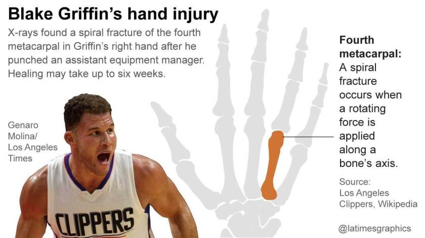 Clippers Blake Griffin Will Have More Time To Recover From Quadriceps Injury Los Angeles Times