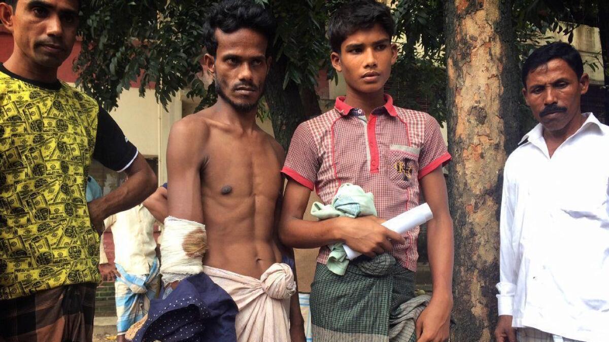 Rohingya Muslims in Cox Bazar, Bangladesh, display bullet wounds they say were inflicted by Myanmar army soldiers.