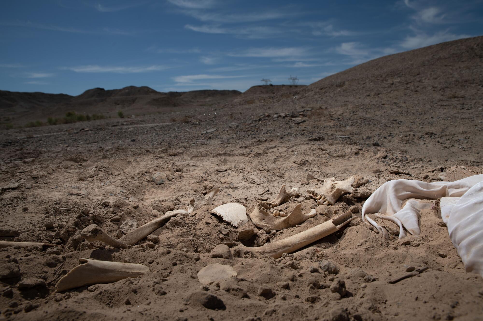 Skeletal human remains lie in the sand under blue skies