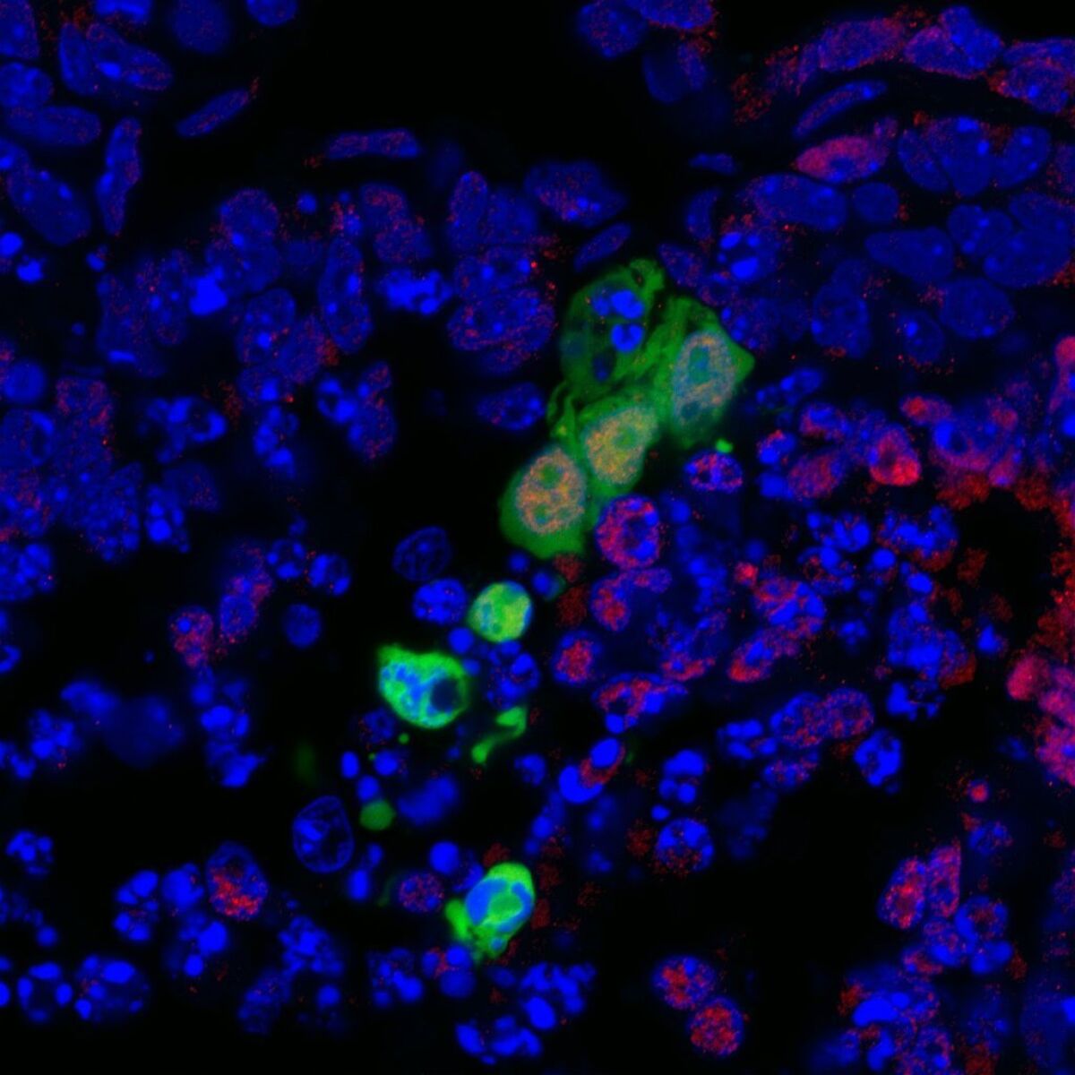 A newly discovered type of human stem cells is shown in green integrating and developing into the surrounding cells of a nonviable mouse embryo. Red indicates cells of endoderm lineage. Endoderm cells can give rise to tissue that covers organs from the digestive and respiratory systems. The new stem cells, developed at the Salk Institute, holds promise for one day growing replacement functional cells and tissues.