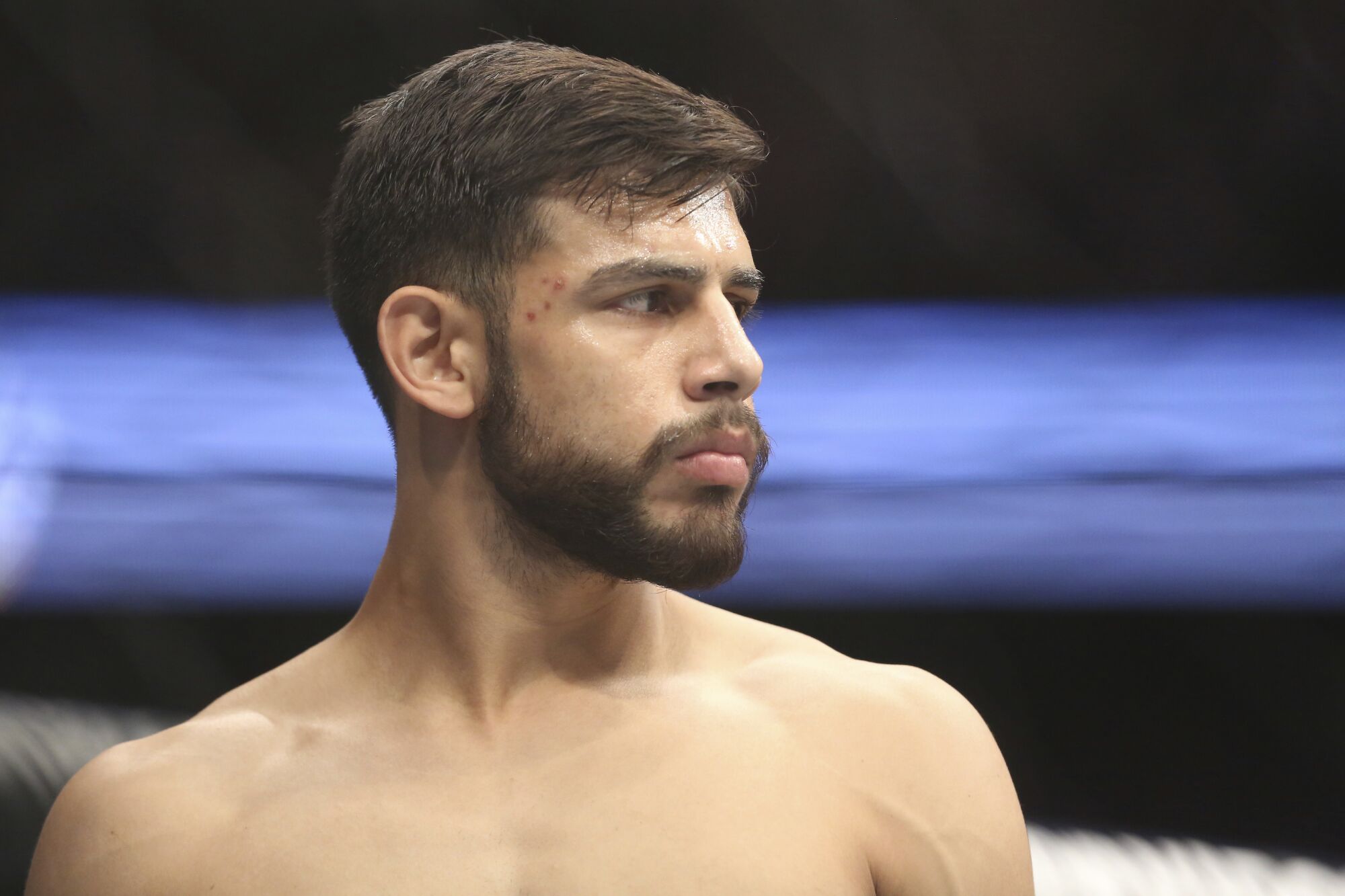 Yair Rodriguez is seen before his figh 