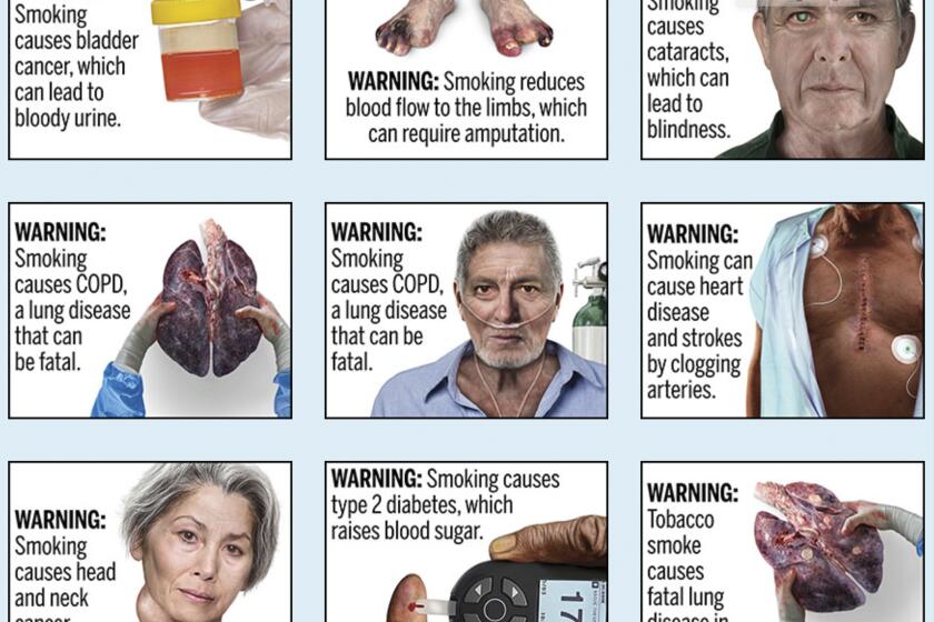 FILE - This image provided by the U.S. Food and Drug Administration, Thursday, Aug. 15, 2019, shows proposed cigarette warning labels. A federal rule requiring that cigarette packs and advertising include graphic images demonstrating the effects of smoking, including pictures of smoke-damaged lungs and feet blackened by diminished blood flow, does not violate the First Amendment, a federal appeals court ruled Thursday, March 21, 2024. (FDA via AP, File)