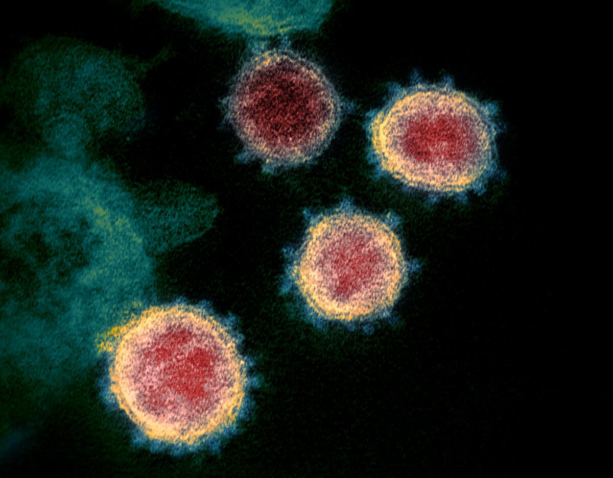 Microscopic view of the coronavirus that causes COVID-19.