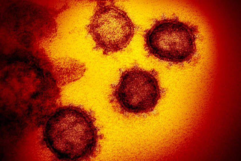 This undated electron microscope image from the U.S. National Institutes of Health in February shows the Novel Coronavirus SARS-CoV-2, the virus causes COVID-19. Scientists say this original version of the coronavirus has mutated and become more infectious.