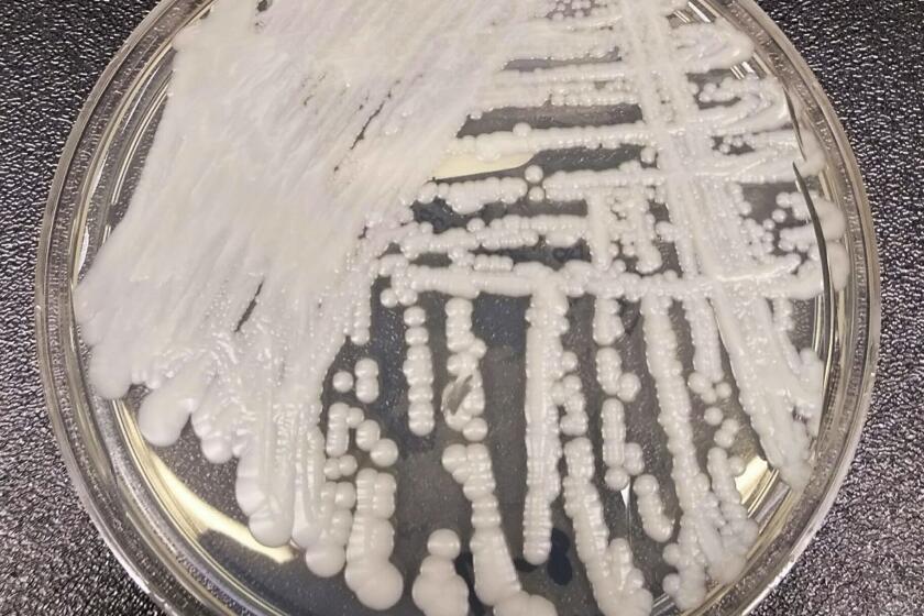 FILE - This undated photo made available by the Centers for Disease Control and Prevention shows a strain of Candida auris cultured in a petri dish at a CDC laboratory. In a CDC paper published by the Annals of Internal Medicine on Monday, March 20, 2023, U.S. cases of the dangerous fungus tripled over just three years, and more than half of states have now reported it. (Shawn Lockhart/Centers for Disease Control and Prevention via AP, File)
