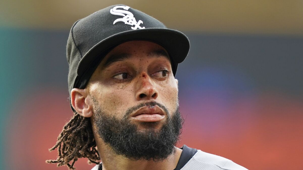 Chicago White Sox's Billy Hamilton runs to the dugout in the fourth inning of a baseball game against the Cleveland Indians, Tuesday, June 1, 2021, in Cleveland. Hamilton was injured in the face sliding into home plate in the second inning. (AP Photo/Tony Dejak)