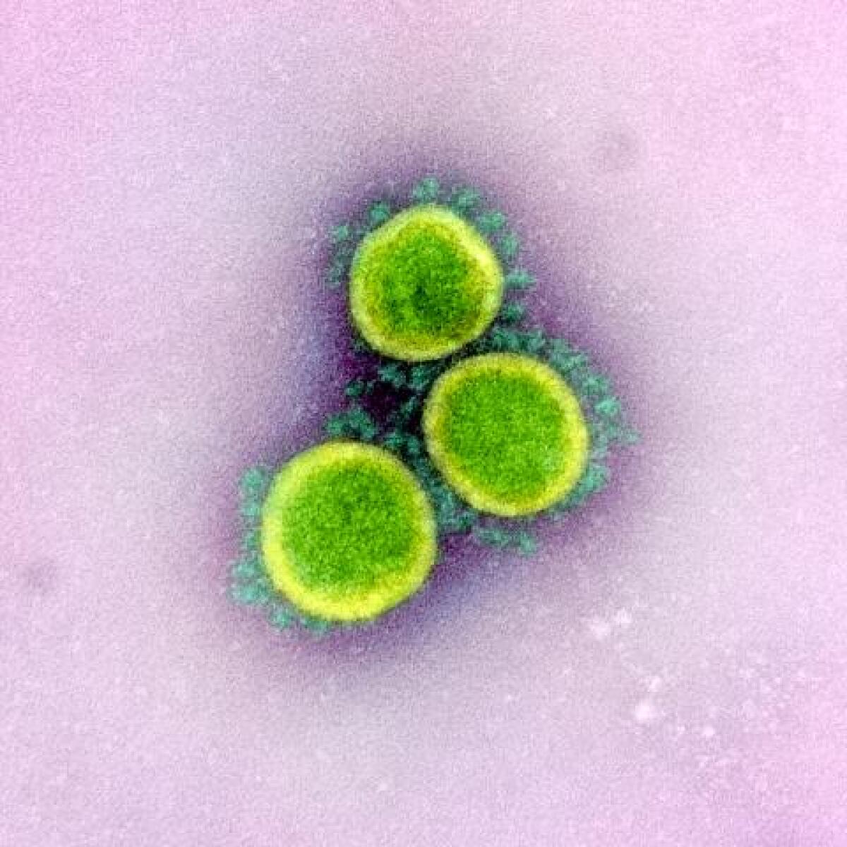 A color-enhanced image of SARS-CoV-2 coronavirus isolated from a patient.