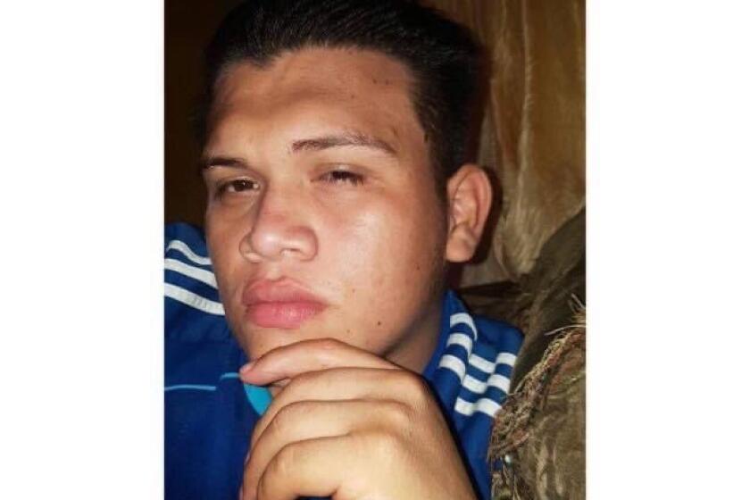 Jerry Felipe Fuentes, de 22 aos, se cayó del tren en Durango (México) en donde perdió el pie izquierdo.