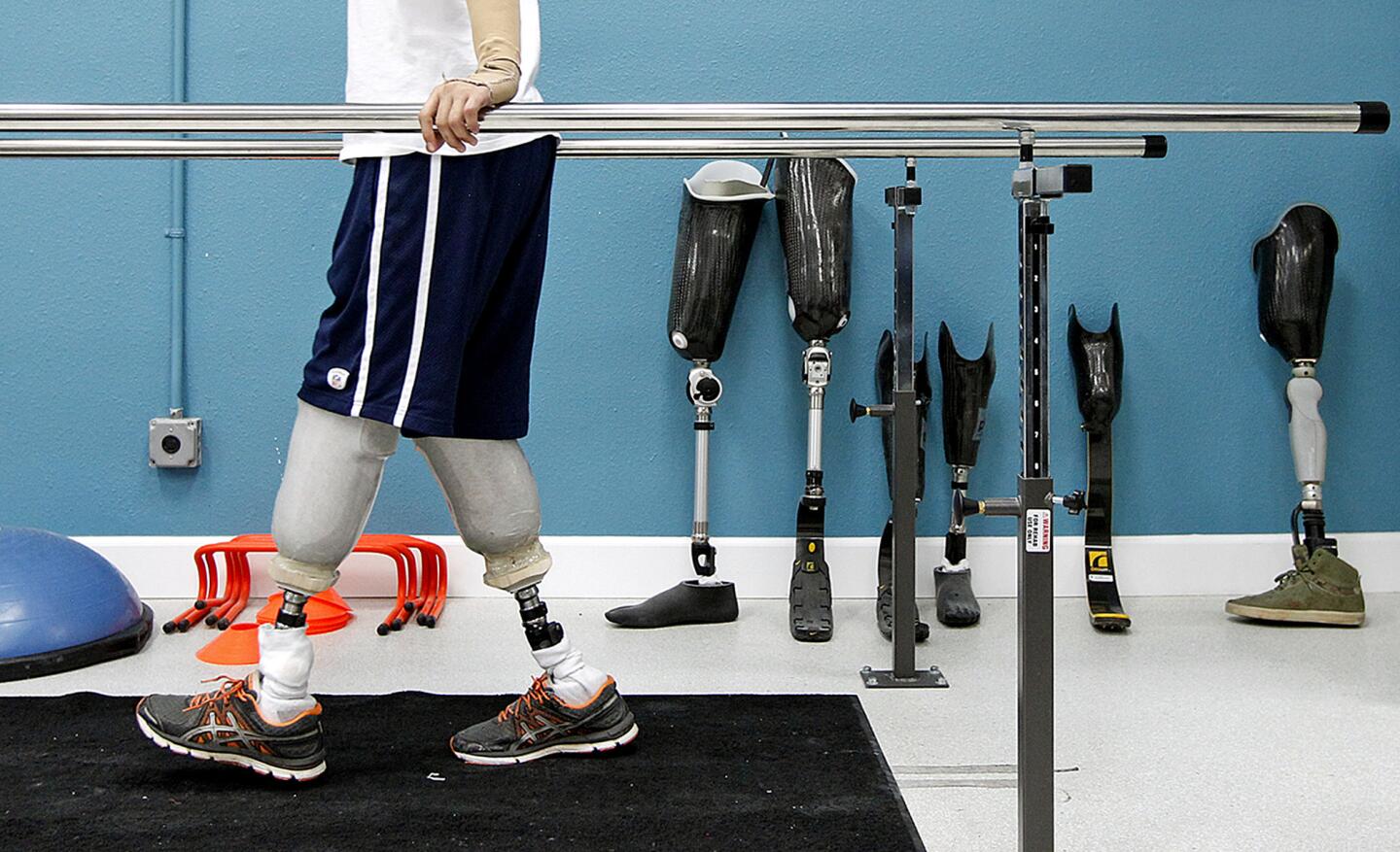 Aaron practices walking on prosthetic legs during a fitting at Peter Harsch Prosthetics in San Diego.