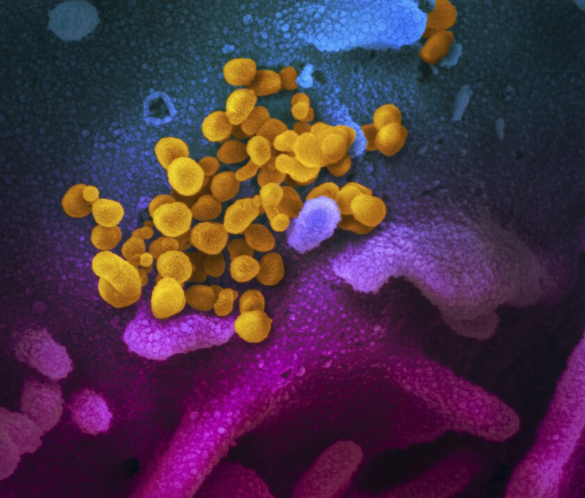 The coronavirus is seen under a microscope.