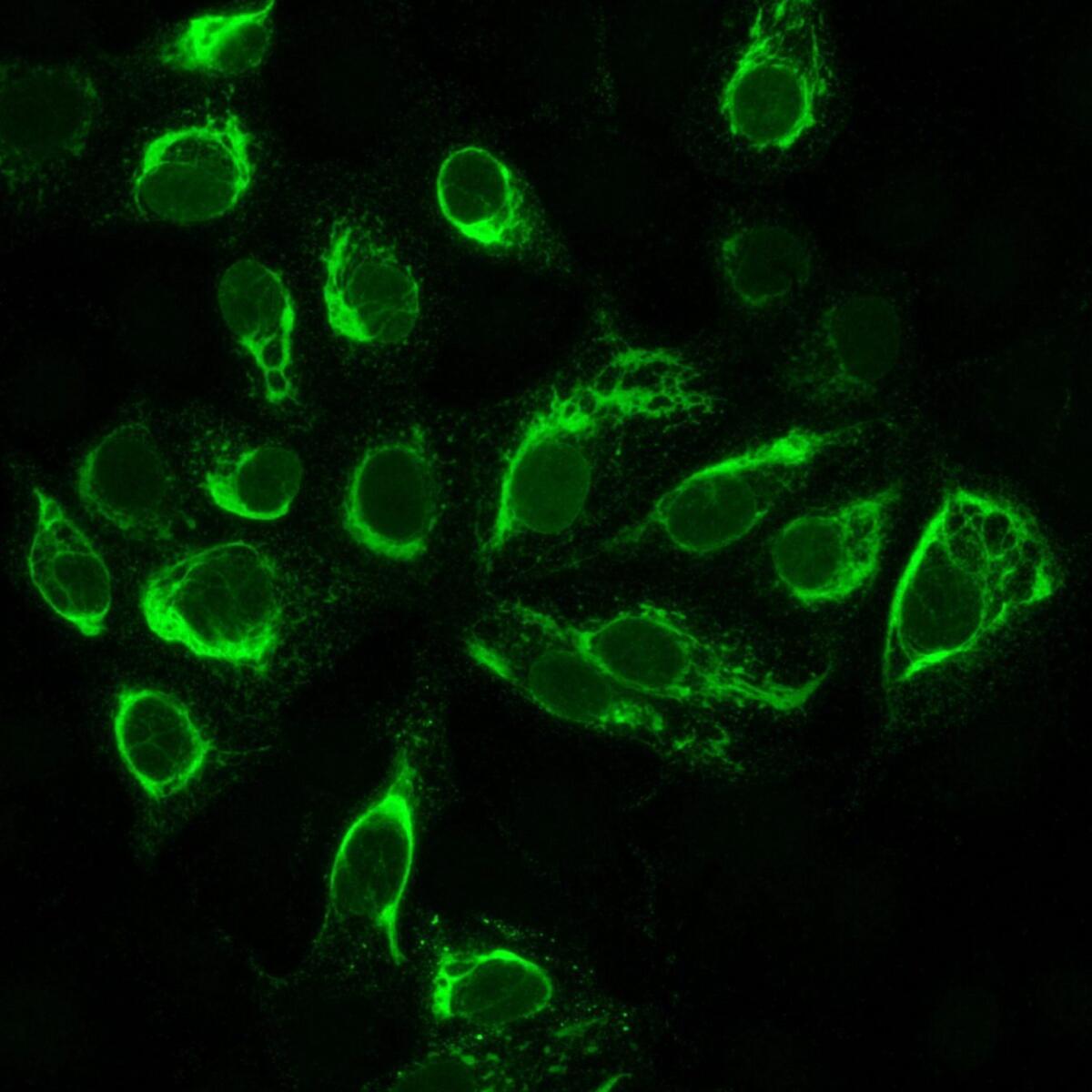 Cultured cells that have been infected with the Zika virus, viewed under a microscope. The cells appear green only if they are infected.