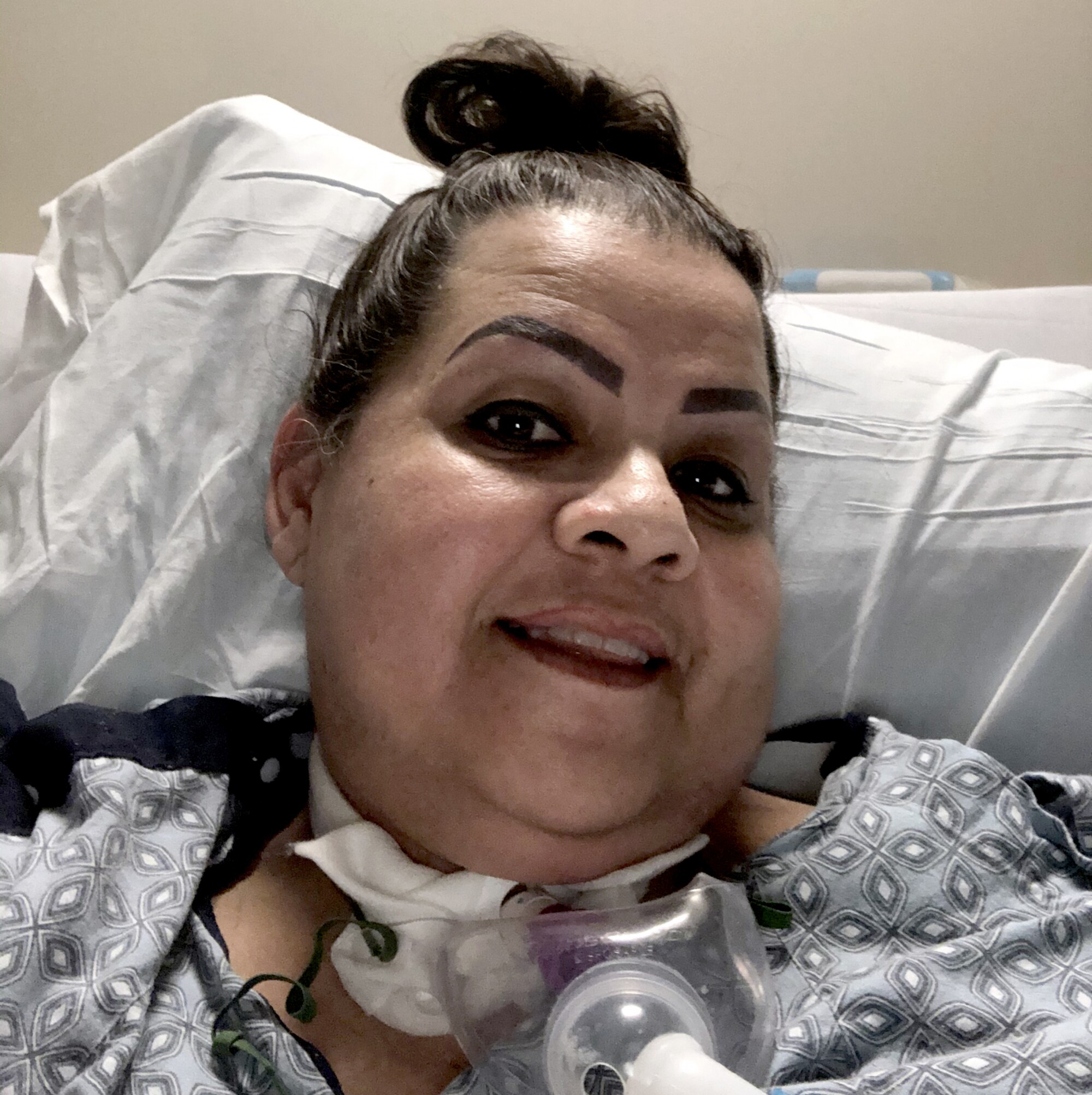 Blanca Lopez without the feeding tube.
