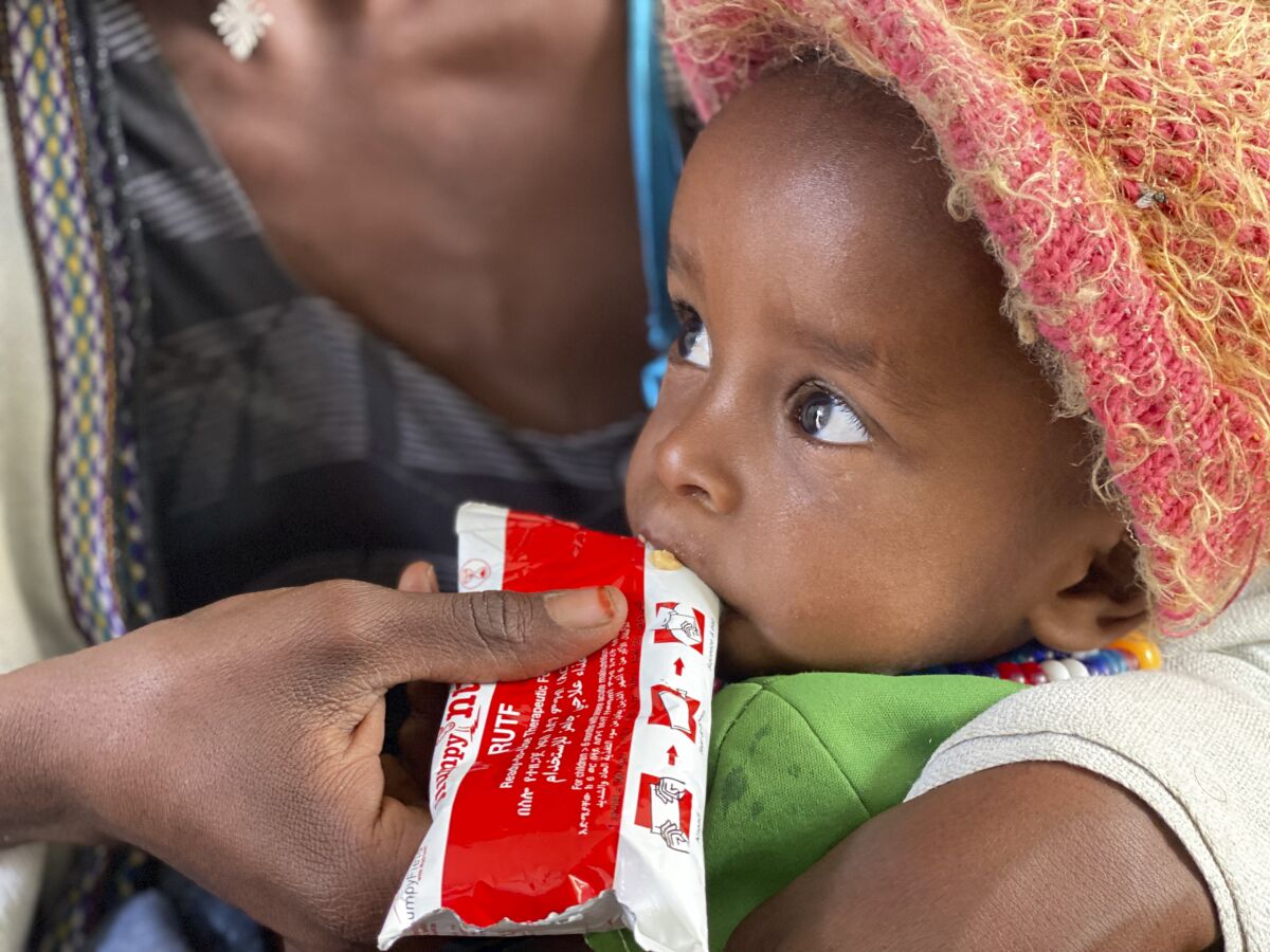 Amanuel Berhanu, held by his mother, eats emergency food after being screened for malnutrition in Debub Health Centre in Wajirat woreda in Southern Tigray in Ethiopia, Monday July 19, 2021. More than 100,000 children in Ethiopia’s embattled Tigray region could face the most extreme and life-threatening form of malnutrition in the next year, the United Nations children’s agency warned on Friday July 30, 2021, as humanitarian aid remains blocked from the region of some 6 million people. (UNICEF via AP)