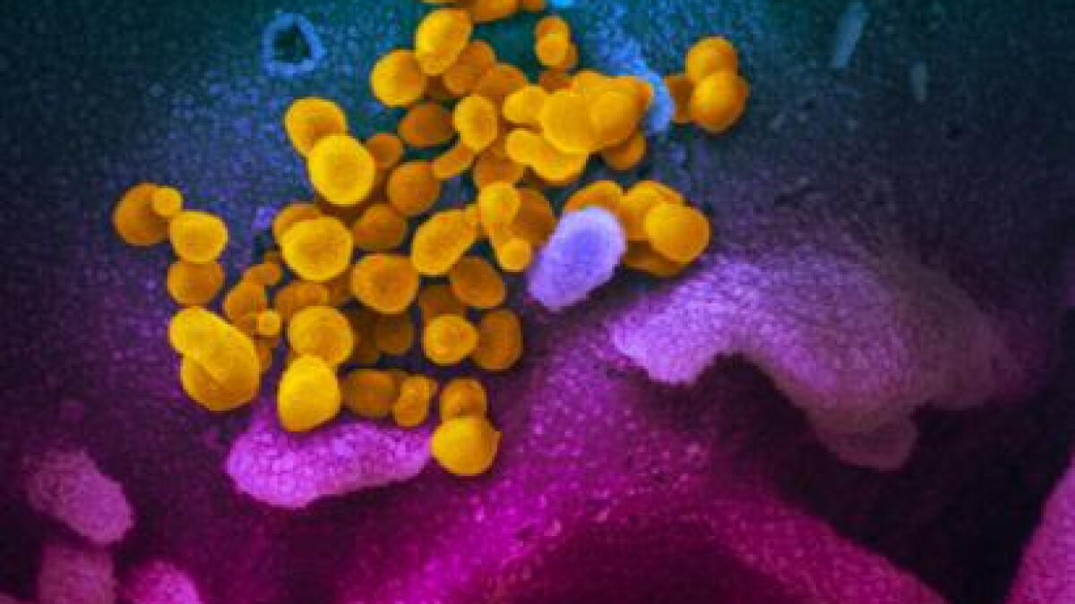 How A Healthy Looking Baby Might Spread The Coronavirus Los Angeles Times