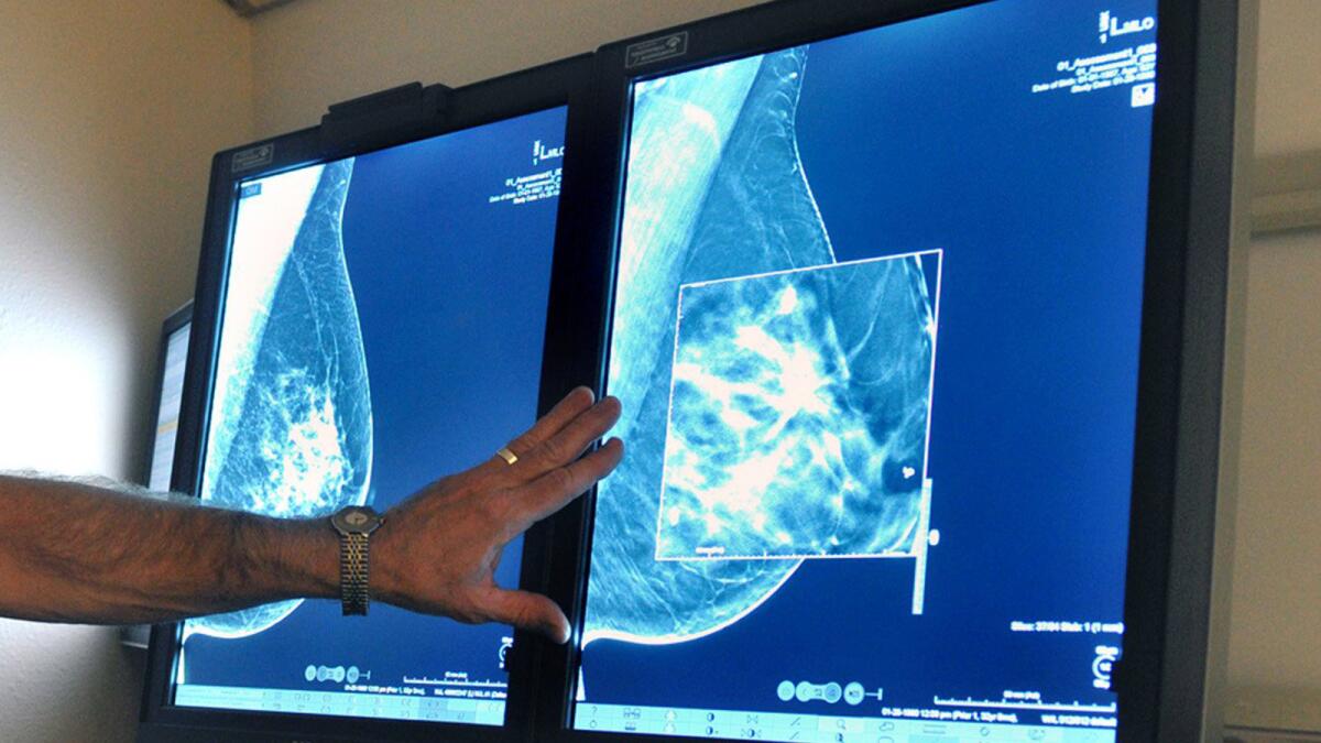 A radiologist looks at mammograms.