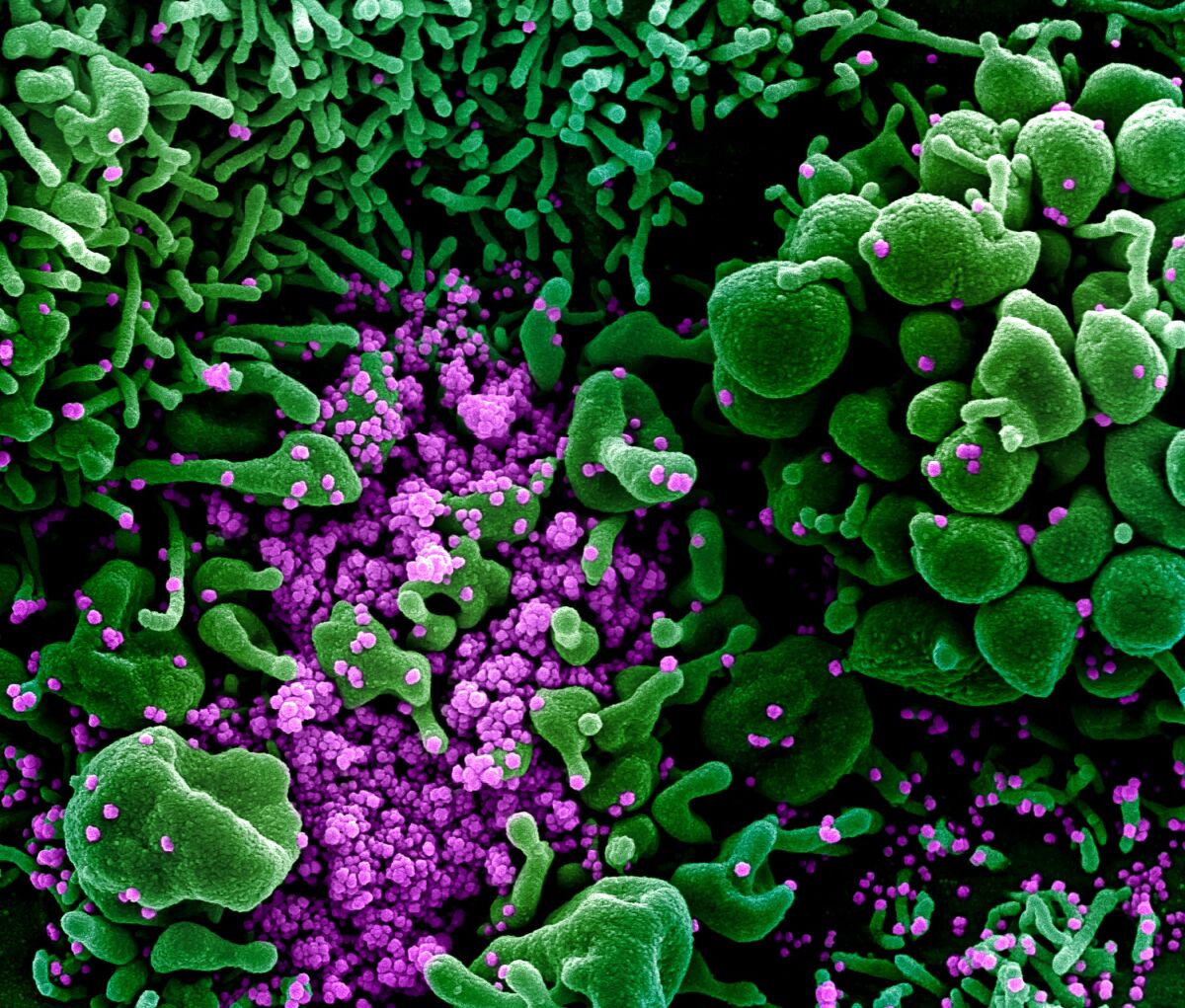 The coronavirus known as SARS-CoV-2, shown in purple, infects a cell, colored in green.