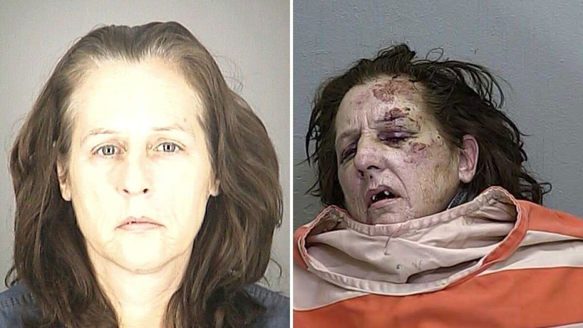 meth effects before and after