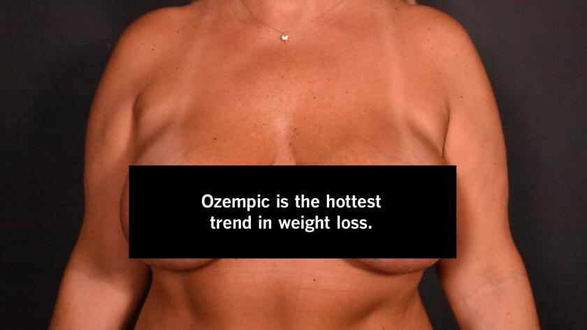 Plastic Surgery Researchers Ask, 'What's the Perfect Breast?