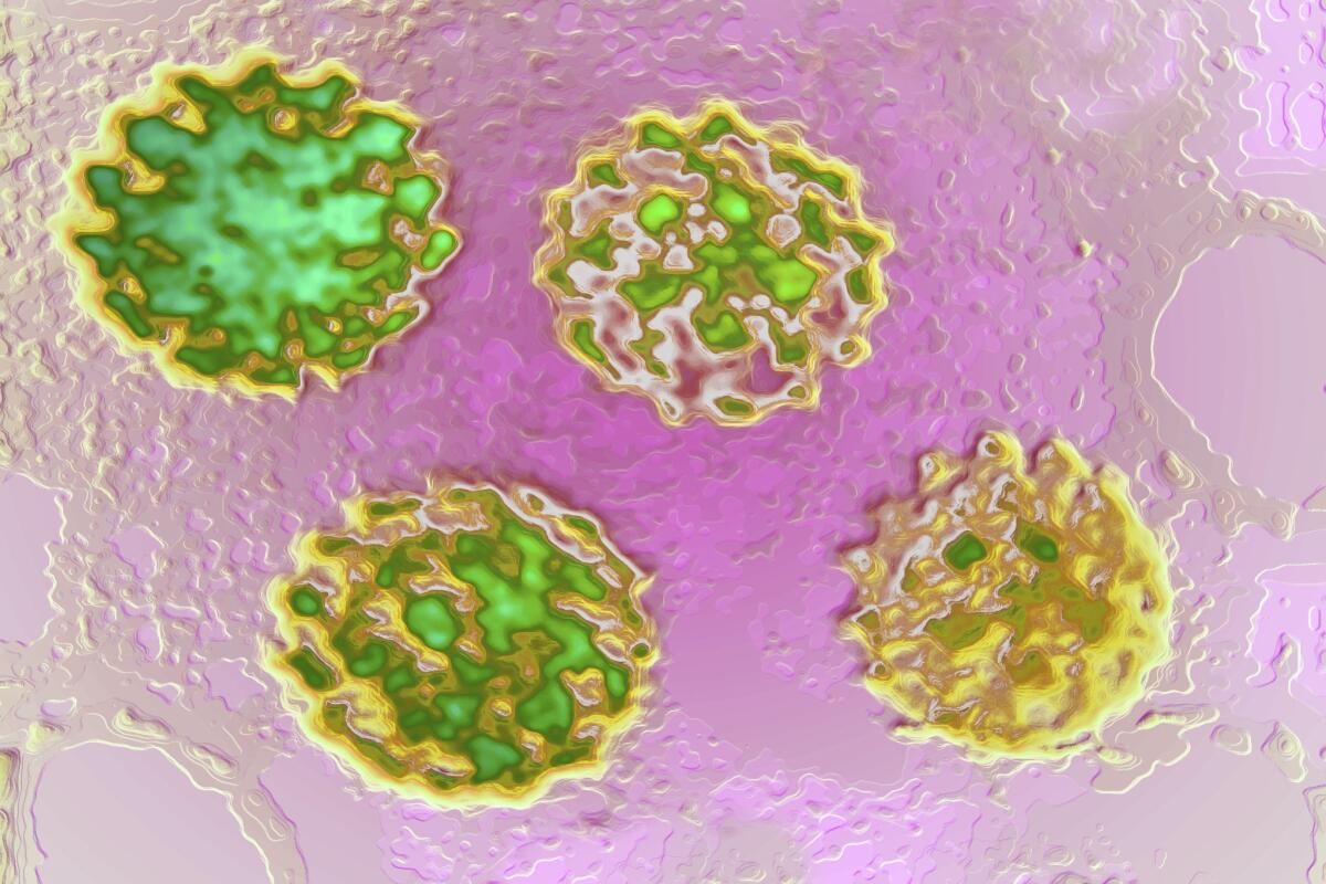 A representation of human papillomavirus cells, magnified by an electron microscope. A clinical trial planned for 2018 will use the CRISPR gene-editing system to attack HPV cells.