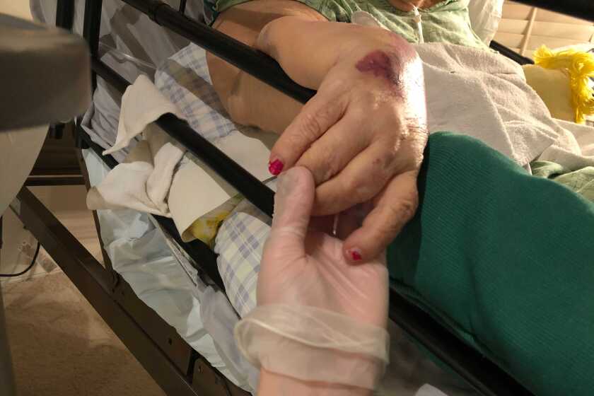 A granddaughter, wearing a glove, holds the hand of her grandmother in hospice