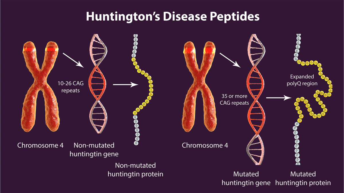 An illustration of Molecular genesis of Huntington's disease, 3D illustration, of the disease on a purple background.