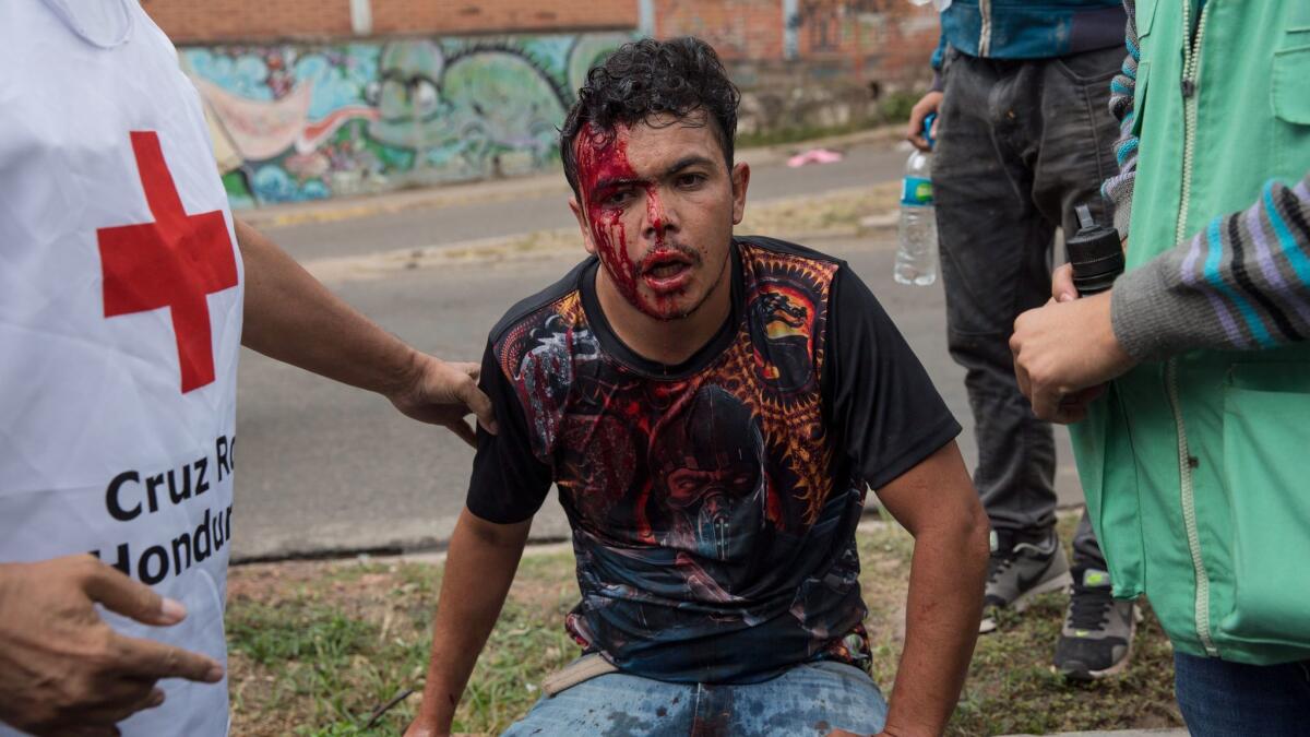 A supporter of opposition presidential candidate Salvador Nasralla is assisted by fellow protesters after being injured during clashes with security forces in Tegucigalpa, Honduras.