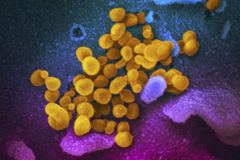 Esta imagen de microscopio electrónico distribuida por los Institutos Nacionales de Salud de EEUU en febrero de 2020 muestra el coronavirus SARS-CoV-2, indicado en amarillo, emergiendo de la superficie de las células (azul/rosa). (NIAID-RML vía AP, Archivo)
