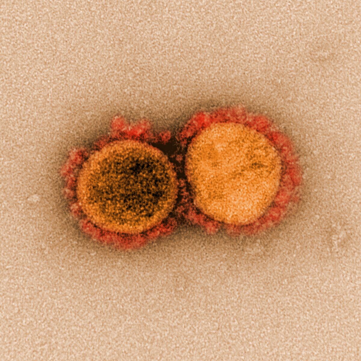 Highly magnified SARS-CoV-2 virus particles 