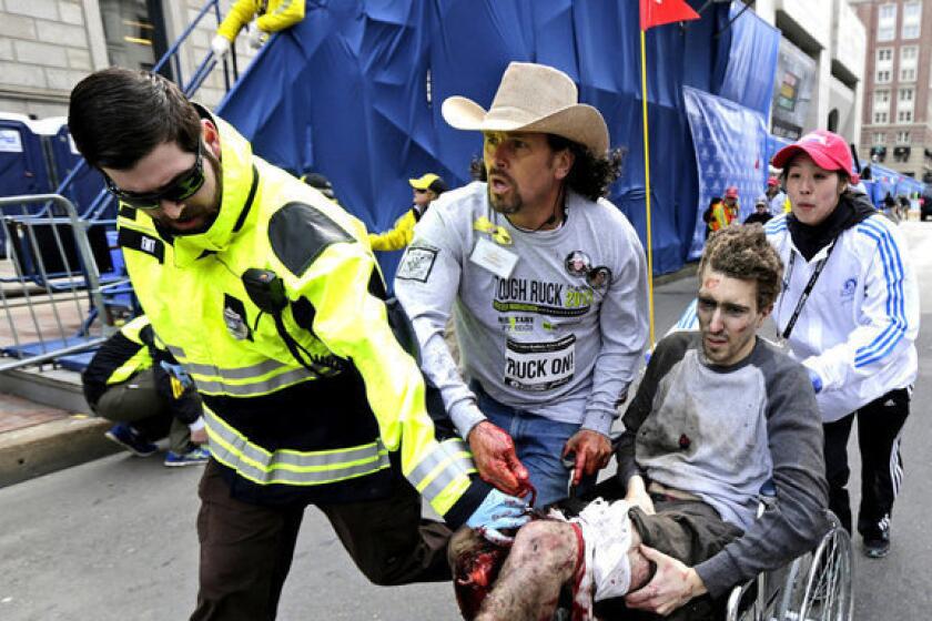 Jeff Bauman had both legs amputated above the knee after being injured in the bombing at the Boston Marathon.