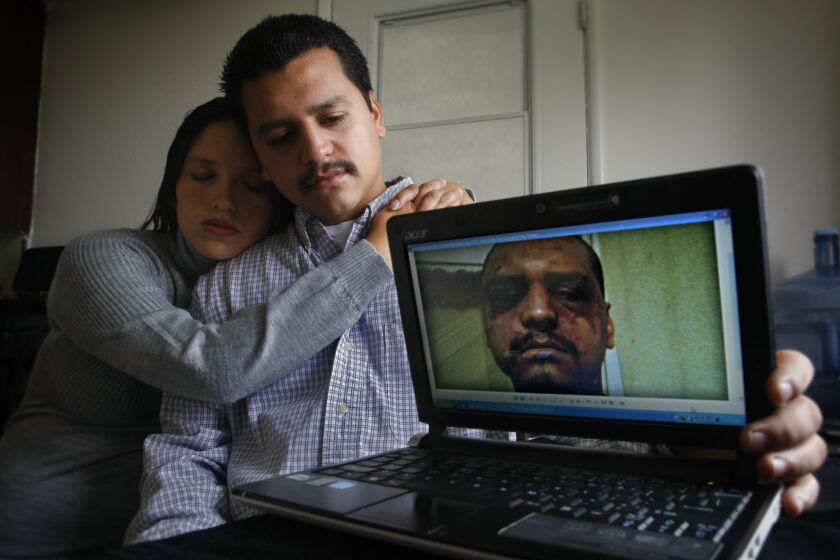 Gabriel Carrillo and his then-girlfriend -- now his wife -- show a photo she took of Carrillo a few days after he was severely beaten by L.A. County Sheriff's deputies in Men's Central Jail.