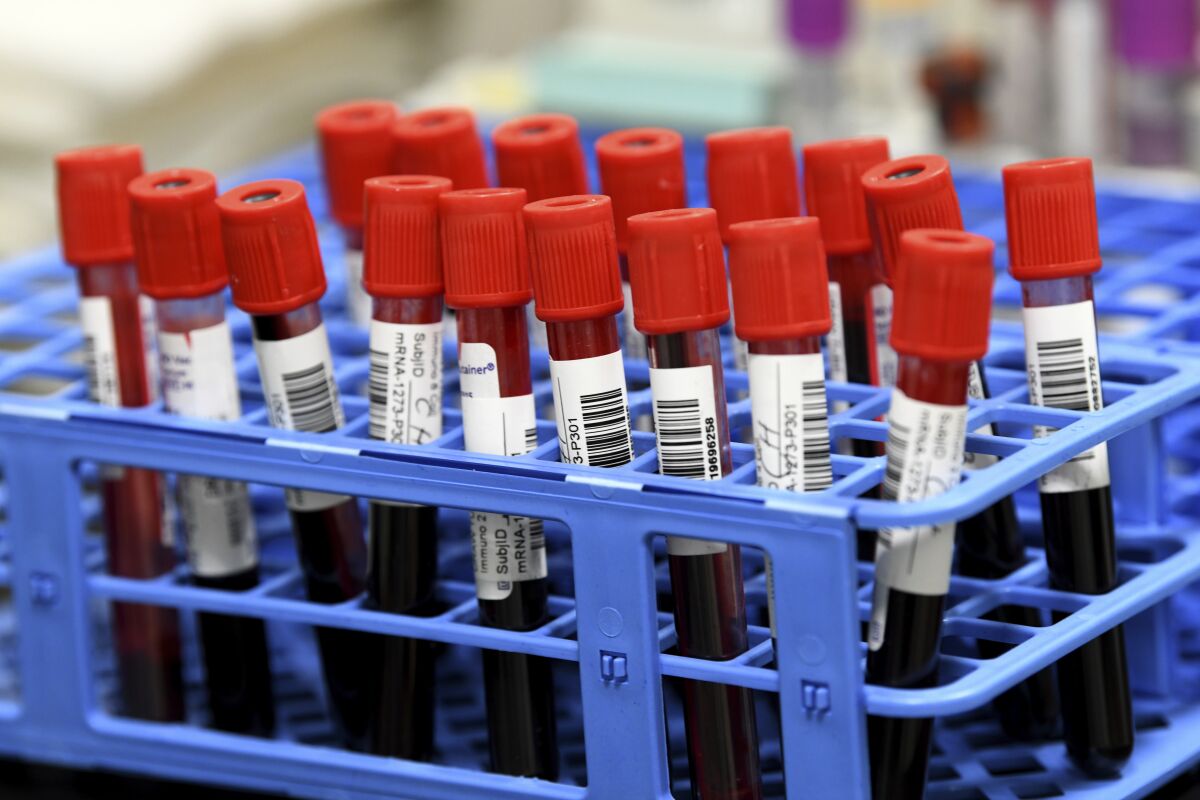 Blood samples are shown, labeled, in upright tubes in a plastic carrier.