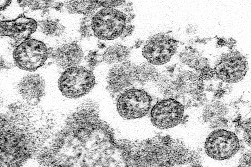 Microscope image of coronavirus particles