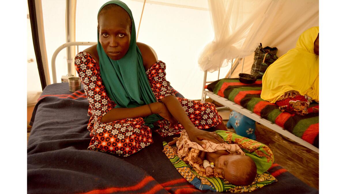 Yagana Goni's 3-month-old baby, Mohammed, is so weak that when he opens his tiny mouth to cry, no sound escapes.